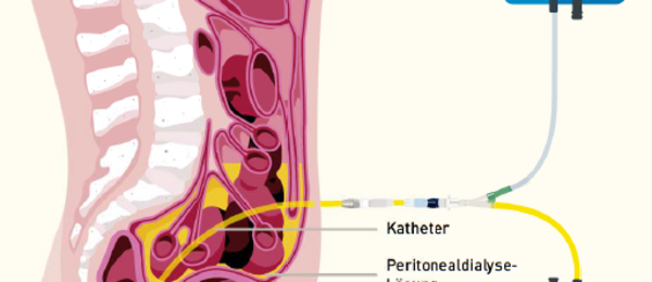 PD Anatomie Poster